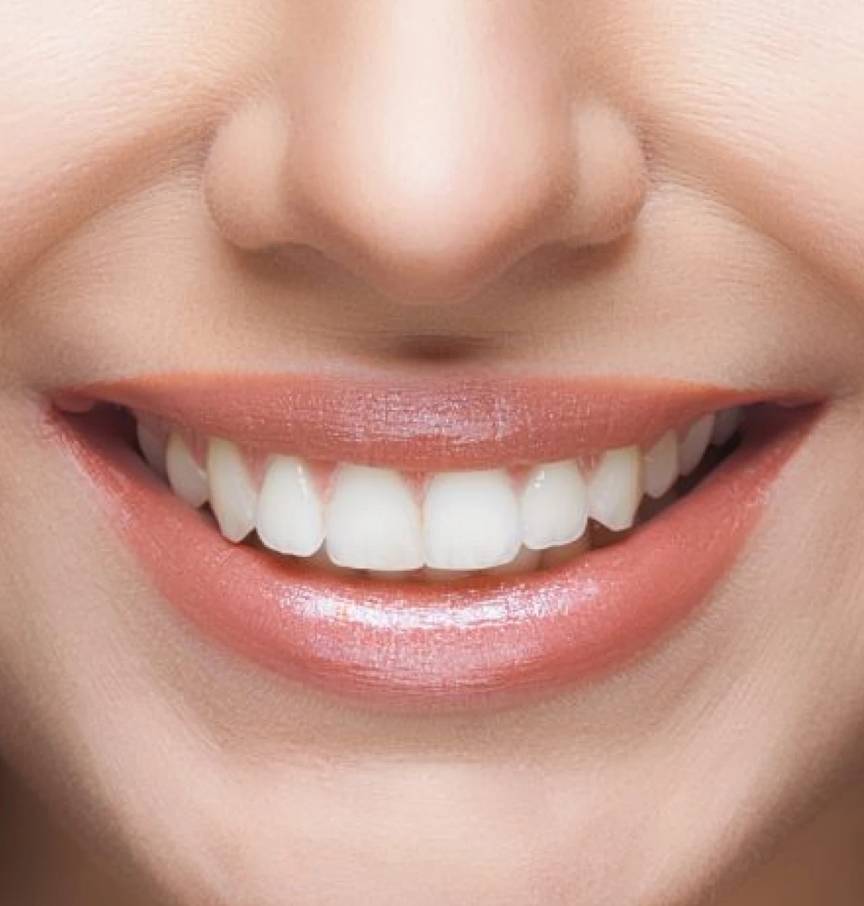 Dents naturelles et esthetiques