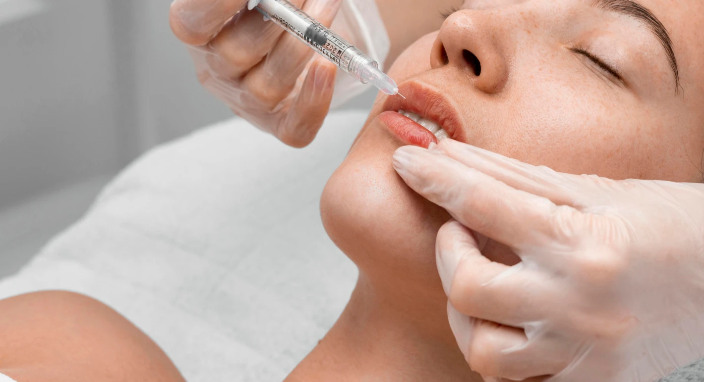 Procédure d'injection d'acide hyaluronique dans les lèvres